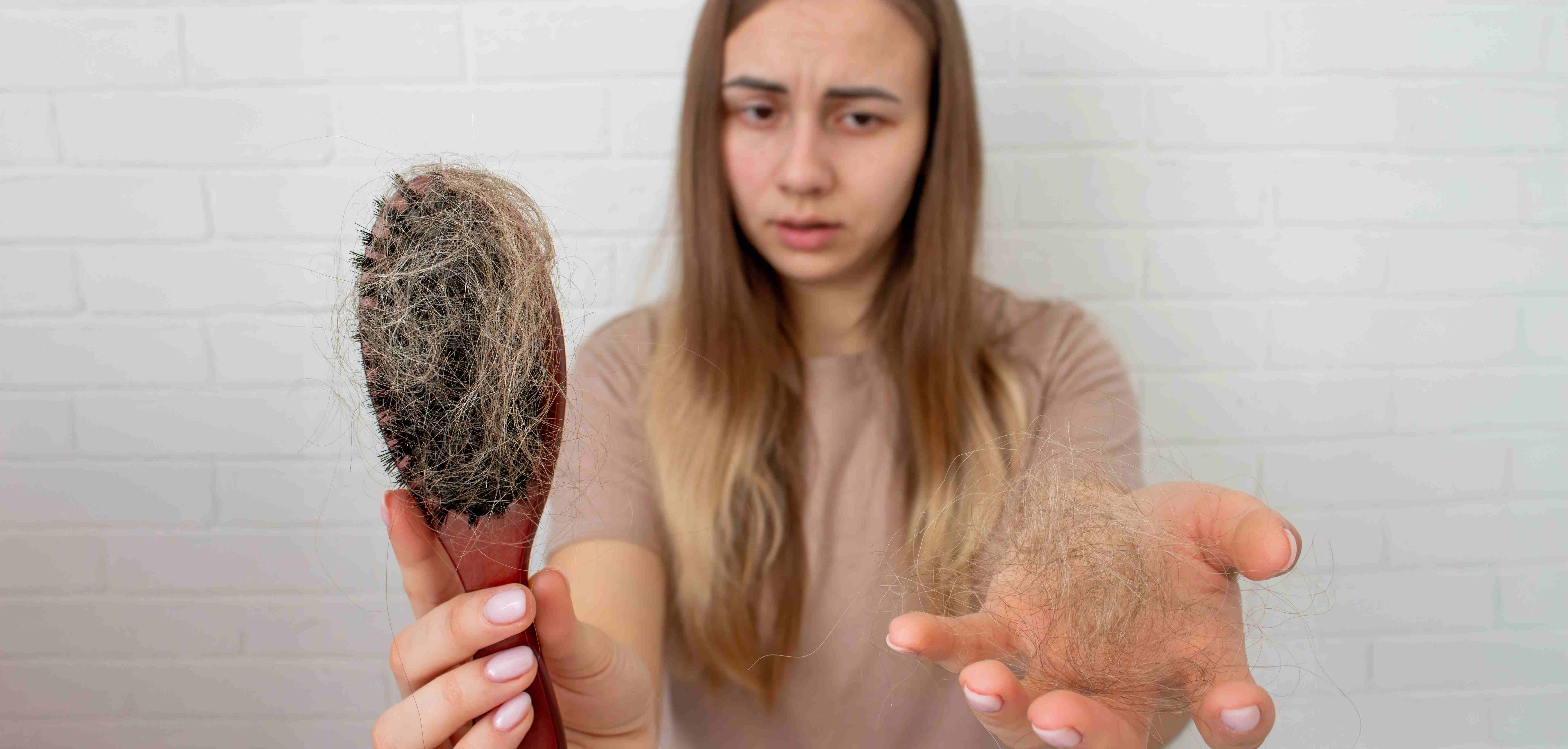 Worried woman holding a clump of hair and a hairbrush full of hair, showing signs of postpartum hair loss.